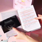 Můj těhotenský deník Albi