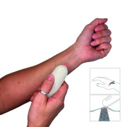 Přístroj na ošetření bodnutí hmyzem Büg